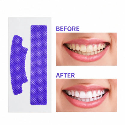 Teeth Whitening Strips – Enamel Safe Whitening Strips for Stain Removal & Brighter Smile